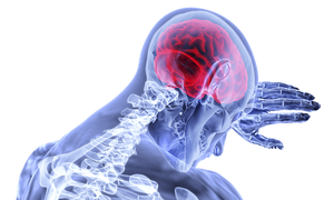 Brain and Nerve Health and Restoration