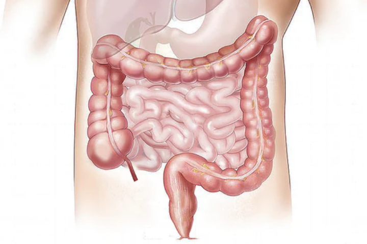 Colon Hydrotherapy - Home Style